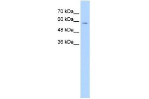 WB Suggested Anti-CES1 Antibody Titration:  1.