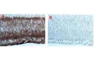 IF - Dab1 Antibody Immunohistochemical staining after cryofixation and sectioning of mouse brain tissue using (A) a 1:5,000 dilution of anti-Dab-1 and (B) 1:5,000 dilution of pre-immune serum followed by processing with HRP Goat anti-Rabbit IgG [H&L] and chromogenic substrate. (DAB1 antibody  (AA 400-555))