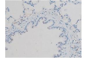 ABIN6256297 and ABIN6267410 at 1/200 staining Rat lung tissue sections by IHC-P. (Connexin 43/GJA1 antibody  (pSer368))