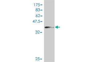 Western Blot detection against Immunogen (38. (PMS1 antibody  (AA 26-135))