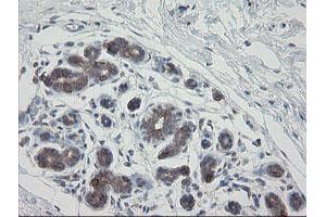 Immunohistochemical staining of paraffin-embedded Human breast tissue using anti-VBP1 mouse monoclonal antibody.