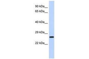 Image no. 1 for anti-EF-Hand Domain Family, Member D2 (EFHD2) (N-Term) antibody (ABIN6741472) (EFHD2 antibody  (N-Term))
