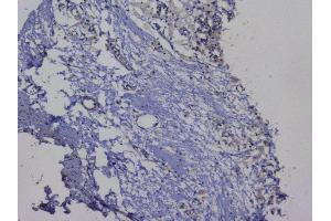 IHC analysis of NRF1 using anti-NRF1 antibody (ABIN6719347).