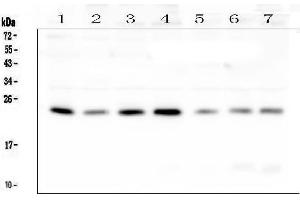 Western blot analysis of RAB11B using anti-RAB11B antibody (ABIN6719364). (RAB11B antibody)