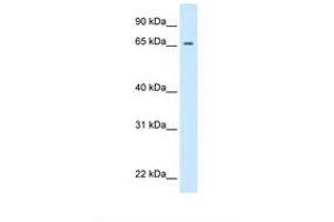 Primary Retinal Dysplasia (PRD) (N-Term) antibody