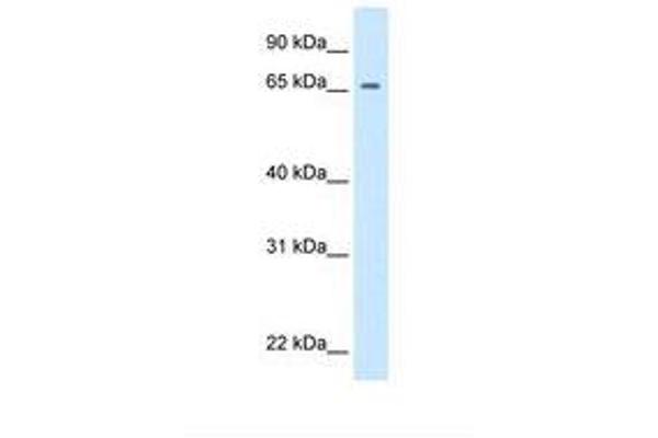 Primary Retinal Dysplasia (PRD) (N-Term) antibody