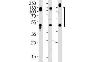Western blot analysis of lysate from HeLa, HT1080 and human placenta lysate (left to right), using LAMP1 antibody at 1:1000.