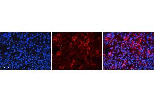 Rabbit Anti-EIF3B Antibody   Formalin Fixed Paraffin Embedded Tissue: Human Lymph Node Tissue Observed Staining: Cytoplasm Primary Antibody Concentration: 1:600 Other Working Concentrations: N/A Secondary Antibody: Donkey anti-Rabbit-Cy3 Secondary Antibody Concentration: 1:200 Magnification: 20X Exposure Time: 0. (EIF3B antibody  (C-Term))