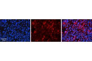 Rabbit Anti-EIF3B Antibody   Formalin Fixed Paraffin Embedded Tissue: Human Lymph Node Tissue Observed Staining: Cytoplasm Primary Antibody Concentration: 1:600 Other Working Concentrations: N/A Secondary Antibody: Donkey anti-Rabbit-Cy3 Secondary Antibody Concentration: 1:200 Magnification: 20X Exposure Time: 0. (EIF3B antibody  (C-Term))