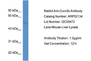 WB Suggested Anti-Coro2b  Antibody Titration: 0. (CORO2B antibody  (C-Term))