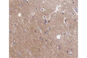 ABIN6266482 at 1/200 staining human brain tissue sections by IHC-P. (GNaZ antibody)