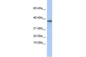 WB Suggested Anti-GLYAT Antibody Titration:  0. (GLYAT antibody  (N-Term))