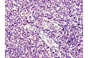 Immunohistochemistry of paraffin-embedded human lymph node tissue using ABIN7171071 at dilution of 1:100 (SMARCD1 antibody  (AA 7-124))