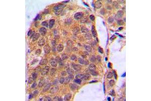 Immunohistochemistry (IHC) image for anti-Mitogen-Activated Protein Kinase 1/3 (MAPK1/3) (C-Term) antibody (ABIN7296704)