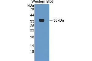 Detection of Recombinant TPSb2, Mouse using Polyclonal Antibody to Tryptase Beta 2 (TPSb2) (TPSB2 antibody  (AA 30-276))