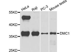 Western blot analysis of extracts of various cell lines, using DMC1 antibody (ABIN5972548) at 1/1000 dilution. (DMC1 antibody)