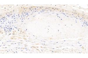 Detection of MYH9 in Human Placenta Tissue using Polyclonal Antibody to Myosin Heavy Chain 9, Non Muscle (MYH9) (Myosin 9 antibody  (AA 1740-1960))