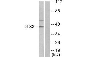 Western Blotting (WB) image for anti-Distal-Less Homeobox 3 (DLX3) (Internal Region) antibody (ABIN1848996) (DLX3 antibody  (Internal Region))
