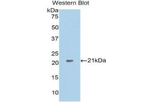 Western Blotting (WB) image for anti-Actin Related Protein 2/3 Complex, Subunit 4, 20kDa (ARPC4) (AA 3-163) antibody (ABIN1858080) (ARPC4 antibody  (AA 3-163))