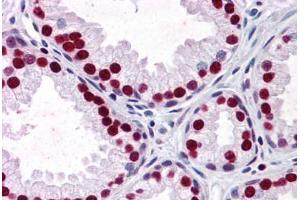 Human Prostate: Formalin-Fixed, Paraffin-Embedded (FFPE) (SMAD6 antibody  (AA 285-385))
