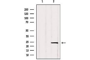 Western blot analysis of extracts from Rat lung, using RGS2 Antibody. (RGS2 antibody  (Internal Region))