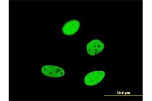 Immunofluorescence of monoclonal antibody to FOXA2 on HeLa cell. (FOXA2 antibody  (AA 363-457))