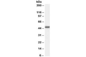 Western blot testing of Jurkat cell lysate with MBD2 antibody at 0. (MBD2 antibody)