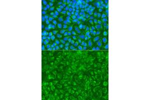 Immunofluorescence analysis of A549 cell using STRN antibody. (Striatin antibody)
