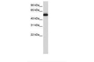 Image no. 1 for anti-Zinc finger protein 82 homolog (ZFP82) (C-Term) antibody (ABIN6736211) (Zinc finger protein 82 homolog (ZFP82) (C-Term) antibody)