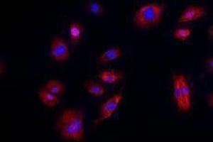 Immunofluorescence (IF) image for anti-Cadherin 5 (CDH5) antibody (Alexa Fluor 594) (ABIN2656818) (Cadherin 5 antibody  (Alexa Fluor 594))
