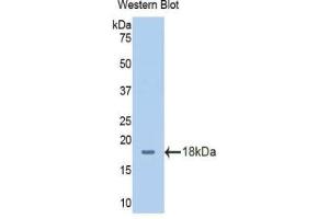 Detection of Recombinant SLC3A2, Human using Polyclonal Antibody to Solute Carrier Family 3, Member 2 (SLC3A2) (SLC3A2 antibody  (AA 213-349))