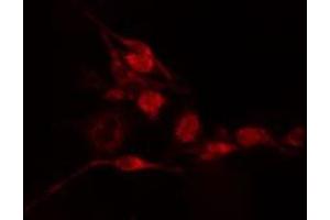 ABIN6275522 staining  Hela cells by IF/ICC. (Septin 2 antibody  (Internal Region))