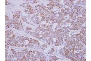 Image no. 1 for anti-Glycosyltransferase-Like Domain Containing 1 (GTDC1) (AA 1-204) antibody (ABIN1498561) (GTDC1 antibody  (AA 1-204))