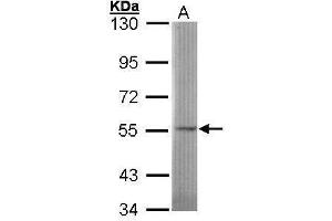 WB Image Sample (30 ug of whole cell lysate) A: 293T 7. (SGSH antibody)