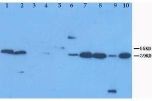 Western Blot analysis of XAF1 expression from cell and tissue extracts with XAF1 polyclonal antibody .