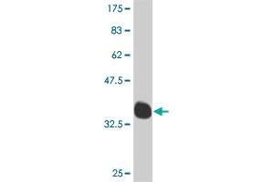 Western Blot detection against Immunogen (35. (MEOX1 antibody  (AA 82-170))