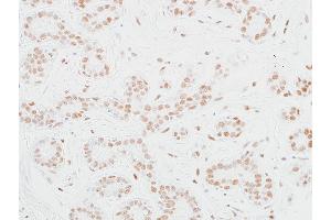 Immunohistochemistry (IHC) image for anti-Mediator Complex Subunit 12 (MED12) (AA 2127-2177) antibody (ABIN7453977) (Recombinant MED12 antibody  (AA 2127-2177))