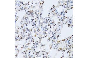 Immunohistochemistry (Paraffin-embedded Sections) (IHC (p)) image for anti-Mitogen-Activated Protein Kinase 3 (MAPK3) (AA 1-100) antibody (ABIN3020725)
