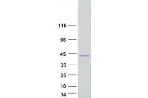 Ras-Related Associated with Diabetes (RRAD) (Transcript Variant 1) protein (Myc-DYKDDDDK Tag)