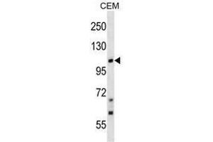 TRPC7 Antibody (C-term) western blot analysis in CEM cell line lysates (35 µg/lane). (TRPC7 antibody  (C-Term))