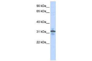Western Blotting (WB) image for anti-Ribose 5-Phosphate Isomerase A (RPIA) antibody (ABIN2459906) (Ribose 5-Phosphate Isomerase A (RPIA) antibody)