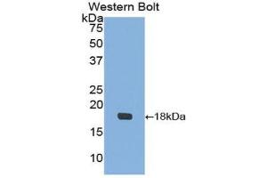 Western Blotting (WB) image for anti-Insulin-Like Growth Factor Binding Protein 3 (IGFBP3) antibody (ABIN1172095) (IGFBP3 antibody)