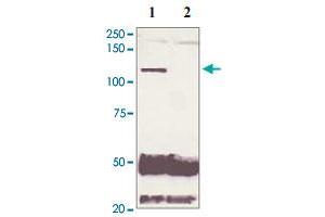 5 mg of the whole cell lysate derived from conditioned LNCaP were immunoprecipitated by 4 ug of Phospho-AR S210 polyclonal antibody (Cat # PAB12654, lane 1) or pre adsorbed by immunization peptide (lane 2) followed by AR polyclonal antibody  at 1 : 500. (Androgen Receptor antibody  (N-Term))
