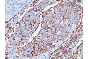 Formalin-fixed, paraffin-embedded human Breast tissue stained with CD44 Mouse Monoclonal Antibody (DF1485). (CD44 antibody)