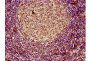 IHC image of ABIN7171386 diluted at 1:80 and staining in paraffin-embedded human lymph node tissue performed on a Leica BondTM system. (CD3 epsilon antibody  (AA 23-207))