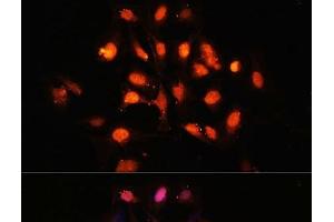 Immunofluorescence analysis of U-2 OS cells using PHLPP1 Polyclonal Antibody at dilution of 1:100 (40x lens).