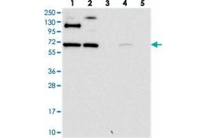 Western blot analysis of Lane 1: RT-4, Lane 2: U-251 MG, Lane 3: Human Plasma, Lane 4: Liver, Lane 5: Tonsil with RUFY2 polyclonal antibody  at 1:250-1:500 dilution. (RUFY2 antibody)