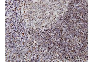 Immunostaining (ISt) image for anti-Interferon, gamma-Inducible Protein 16 (IFI16) (AA 630-729) antibody (ABIN561426)