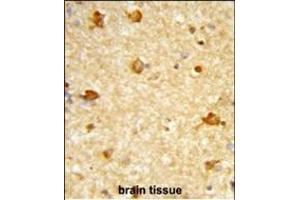 Formalin-fixed and paraffin-embedded human brain tissue reacted with DIRAS1 Antibody (Center), which was peroxidase-conjugated to the secondary antibody, followed by DAB staining. (DIRAS1 antibody  (AA 109-136))