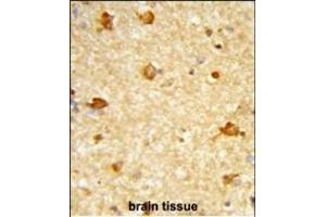 Formalin-fixed and paraffin-embedded human brain tissue reacted with DIRAS1 Antibody (Center), which was peroxidase-conjugated to the secondary antibody, followed by DAB staining.